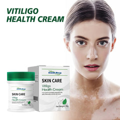 Vitilgo Health Cream Remove Vitiligo White Spots Leukoplakia Pigmentation Melanin Promoting Natural Relief Skin Treatment Cream Vitilgo Health Cream Remove Vitiligo White Spots Leukoplakia Pigmentation Melanin Promoting Natural Relief Skin Treatment Cream
