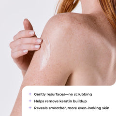 AmLactin KP Bumps Be Gone - 3 oz Keratosis Pilaris Moisturizing Cream with 15% Lactic Acid - Exfoliator and Moisturizer for Dry, Rough and Bumpy Skin (Packaging May Vary)
