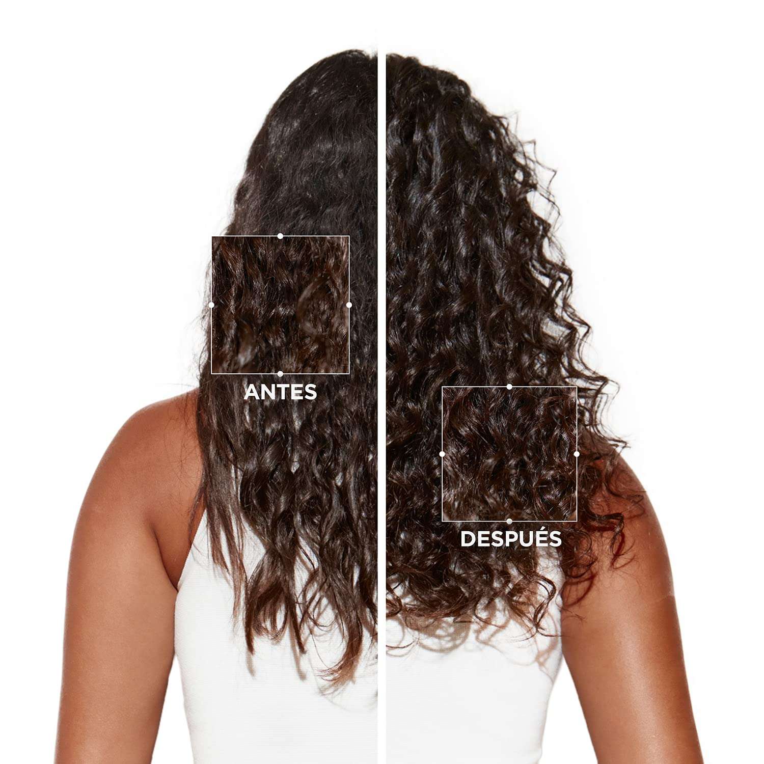 Keratase Shampoo and Symbios Anti-Dandruff Cream, 250ml