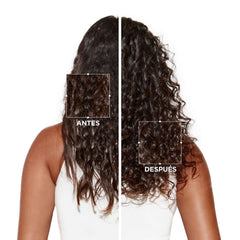 Keratase Shampoo and Symbios Anti-Dandruff Cream, 250ml