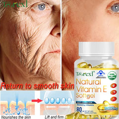 Trorexl Supplementing Vitamin E Capsules Tighten skin brighten complexion Vascular Protective Supplements