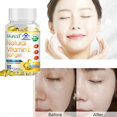 Trorexl Supplementing Vitamin E Capsules Tighten skin brighten complexion Vascular Protective Supplements