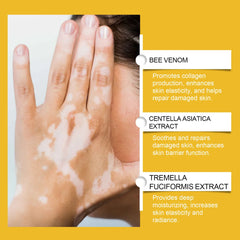 Bee Venom Vitiligo Soothing Cream Repair Leukoplakia Reduce Pigment Evens Skin Tone Treatment White Spot Disease Cream Body Care