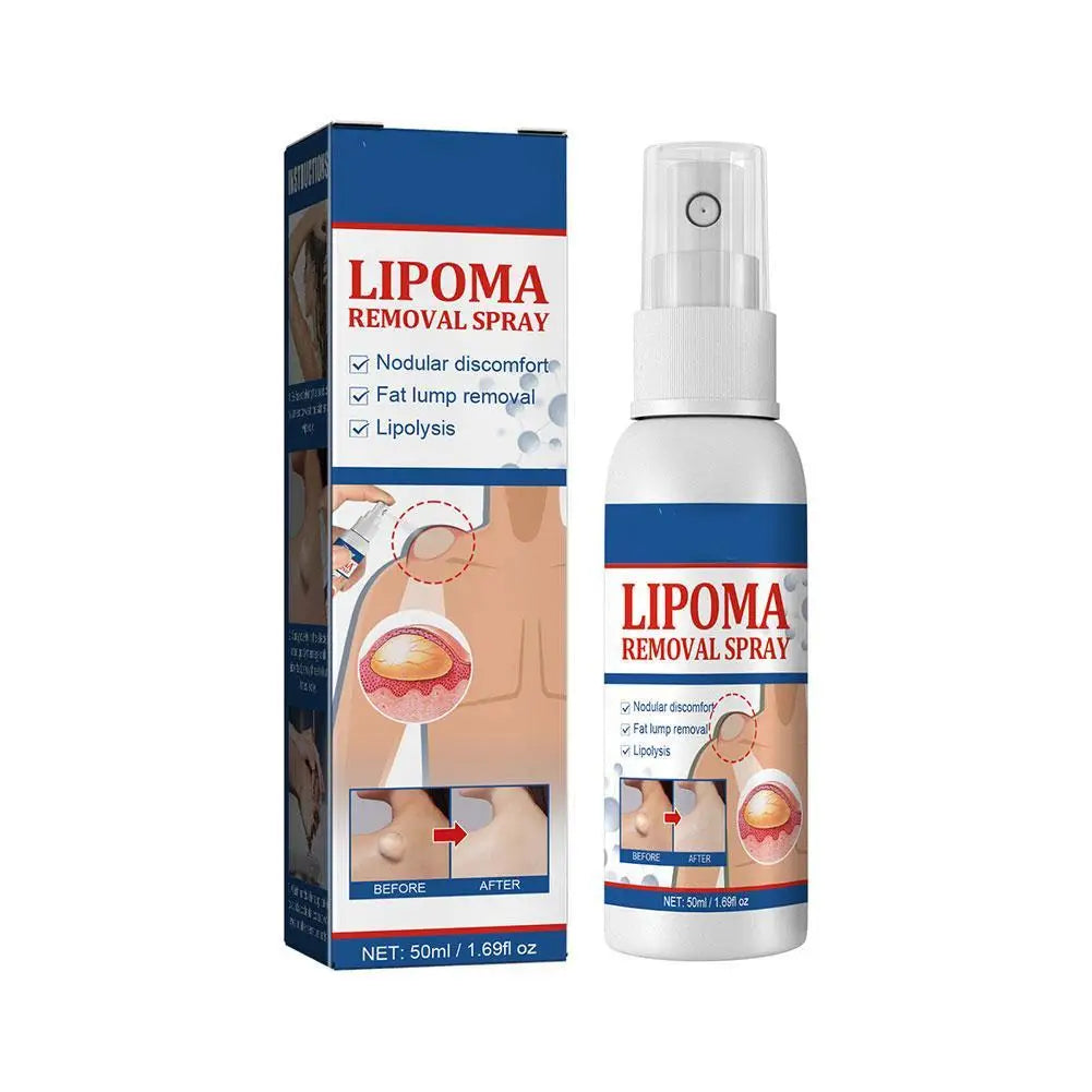 Lipoma Removal Spray Anti Tumor Skin Swelling Pain Lipolysis Cellulite Treatment Fibroma Subcutaneous Fat Lump Relief Cream 50ml