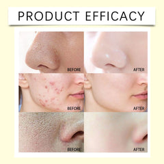 Facial Scrub - Gently Clean Face, Exfoliate, Moisturize, Soften Skin, Brighten Complexion, Improve Skin Texture, 100g