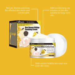Bee Venom Vitiligo Soothing Cream Repair Leukoplakia Reduce Pigment Evens Skin Tone Treatment White Spot Disease Cream Body Care