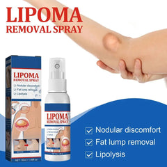 Lipoma Removal Spray Anti Tumor Skin Swelling Pain Lipolysis Cellulite Treatment Fibroma Subcutaneous Fat Lump Relief Cream 50ml