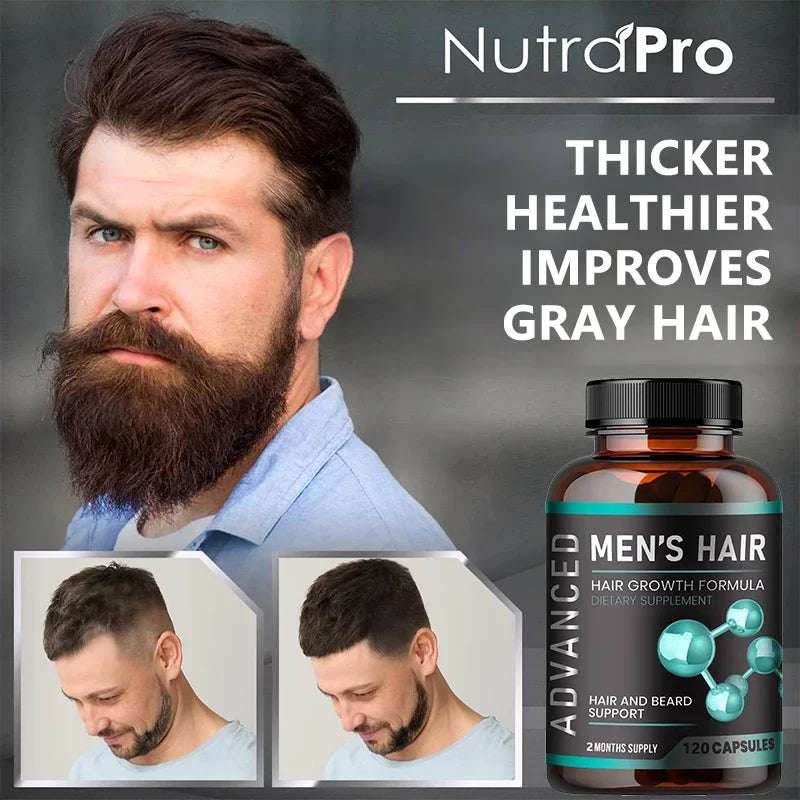 Hair Growth Vitamins for Men - Thick Hair and Beard - Helps with Thinning and Hair Loss, Natural Dietary Supplement