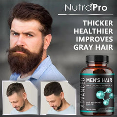Hair Growth Vitamins for Men - Thick Hair and Beard - Helps with Thinning and Hair Loss, Natural Dietary Supplement