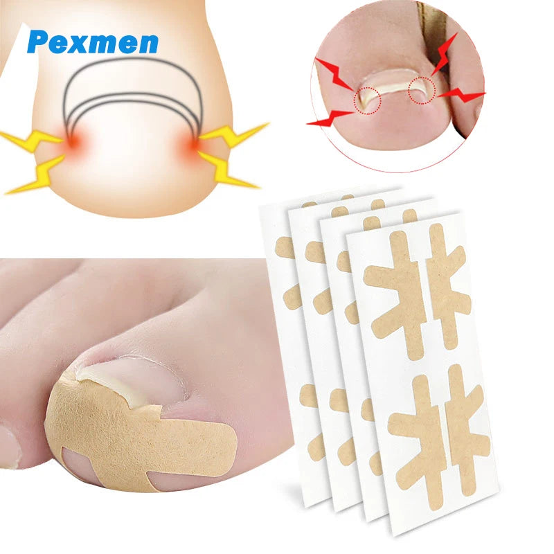 ملصق تصحيح أظافر القدم الناشبة من Pexmen، 4/8/20 قطعة، لاصق تصحيح أظافر القدم، رقعة مرنة لعلاج الأظافر، أدوات باديكير