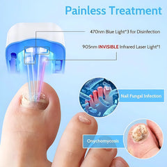 USB Charge Toenail Fungus Laser Device 470nm 905nm Fungal Laser Treatment Device for Fingernail  Foot Repair Nail Fungus Removal