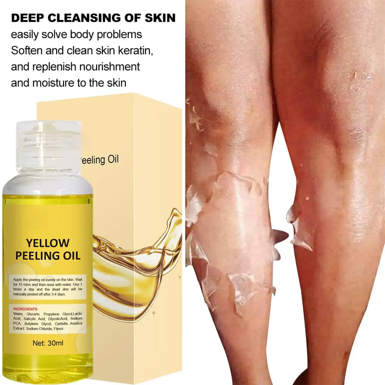 Yellow Peeling Oil Dark Skin Whitening Bleaching Remove Melanin for Arm Knee Legs Body Lightening Scrub Exfoliating Dead Skin