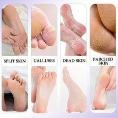 8/10 Pcs Pedicure Set Peeling and Exfoliating Calluses Foot Scrubbing Brush Stainless Steel Double-sided Foot Care Pedal Stone