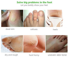 Feet Exfoliating Foot Masks Pedicure Socks Exfoliation Scrub for Feet Mask Pedicure Stone Foot Peeling Mask For Foot Spa