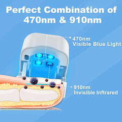USB Charge Toenail Fungus Laser Device 470nm 905nm Fungal Laser Treatment Device for Fingernail  Foot Repair Nail Fungus Removal