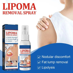 Lipoma Removal Spray Anti Tumor Skin Swelling Pain Lipolysis Cellulite Treatment Fibroma Subcutaneous Fat Lump Relief Cream 50ml