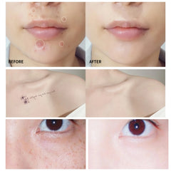 Waterproof Full Coverage Concealer for Tattoos, Scars - Natural Finish Foundation for All Skin Tones & Types