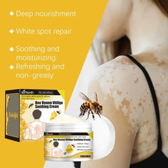 Bee Venom Vitiligo Soothing Cream Repair Leukoplakia Reduce Pigment Evens Skin Tone Treatment White Spot Disease Cream Body Care