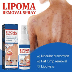 Lipoma Removal Spray Anti Tumor Skin Swelling Pain Lipolysis Cellulite Treatment Fibroma Subcutaneous Fat Lump Relief Cream 50ml