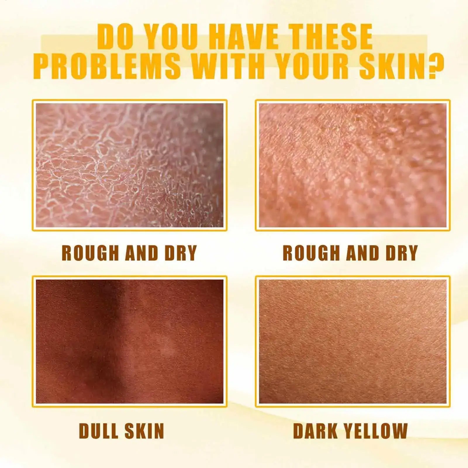 Yellow Peeling Oil Dark Skin Whitening Bleaching Remove Melanin for Arm Knee Legs Body Lightening Scrub Exfoliating Dead Skin