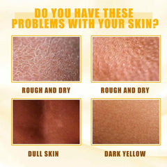 Yellow Peeling Oil Dark Skin Whitening Bleaching Remove Melanin for Arm Knee Legs Body Lightening Scrub Exfoliating Dead Skin
