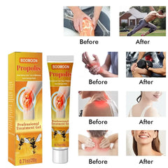 5pcs Bee Venoms Joint Cream Joint And Bone Therapy Cream Massage Treatments Cream Bone Health Body Care Tools Joint Bone Gel