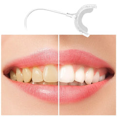 Teeth Whitening Accelerator Smart LED Blue Light Portable USB/iPhone/Android Charging Device Teeth Whitener Light Gum Tray