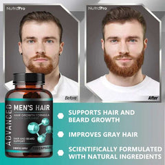 Hair Growth Vitamins for Men - Thick Hair and Beard - Helps with Thinning and Hair Loss, Natural Dietary Supplement