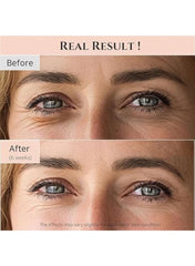 Revive Eye Serum with Retinal, Niacinamide & Peptides | Anti-Wrinkle, Dark Circle & Puffiness Correction | 30ml