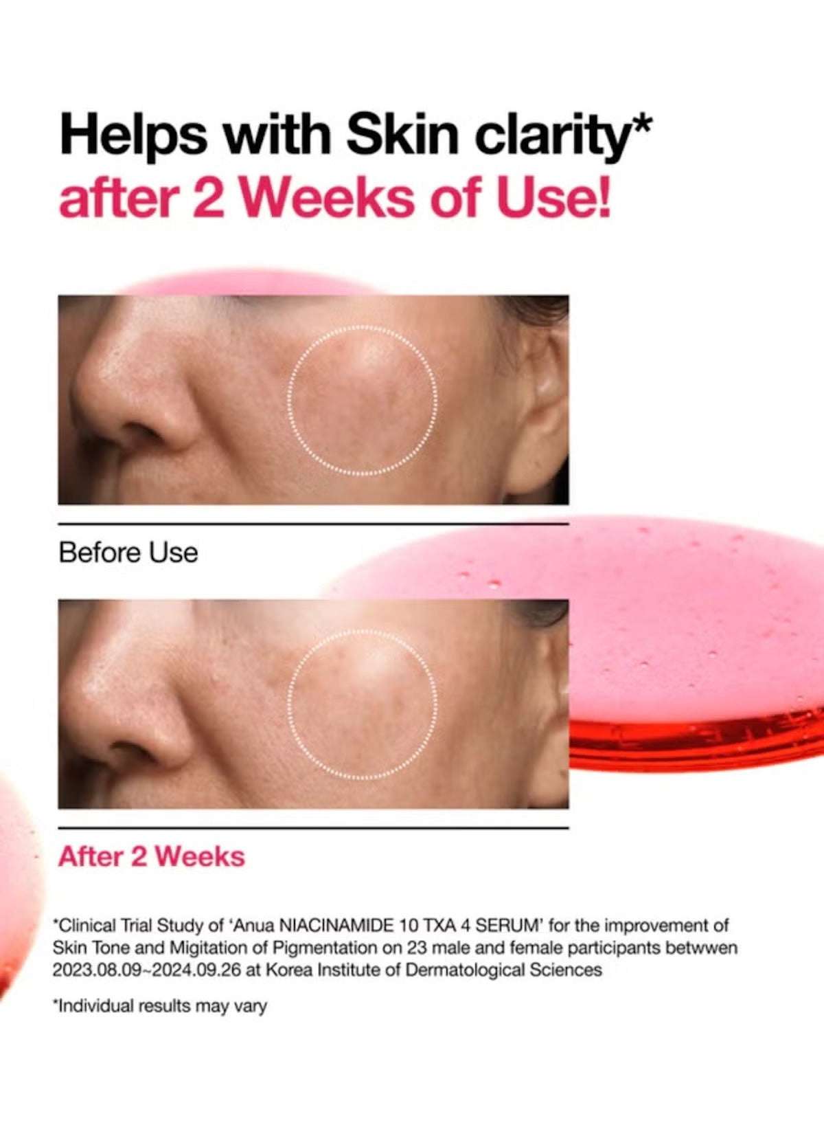 Niacinamide 10% + TXA 4% Serum | 30ml | Brightening & Pore-Refining Korean Face Serum