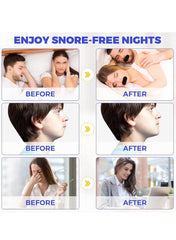Good Night Tape – 30 Patches | Anti-Snoring Sleep Mouth Tape | Soft, Comfortable, Odour-Free Strips for Better Nasal Breathing & Reduced Mouth Dryness