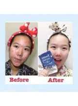 Frozen collagen capsules pouch shown with before-and-after skin photos