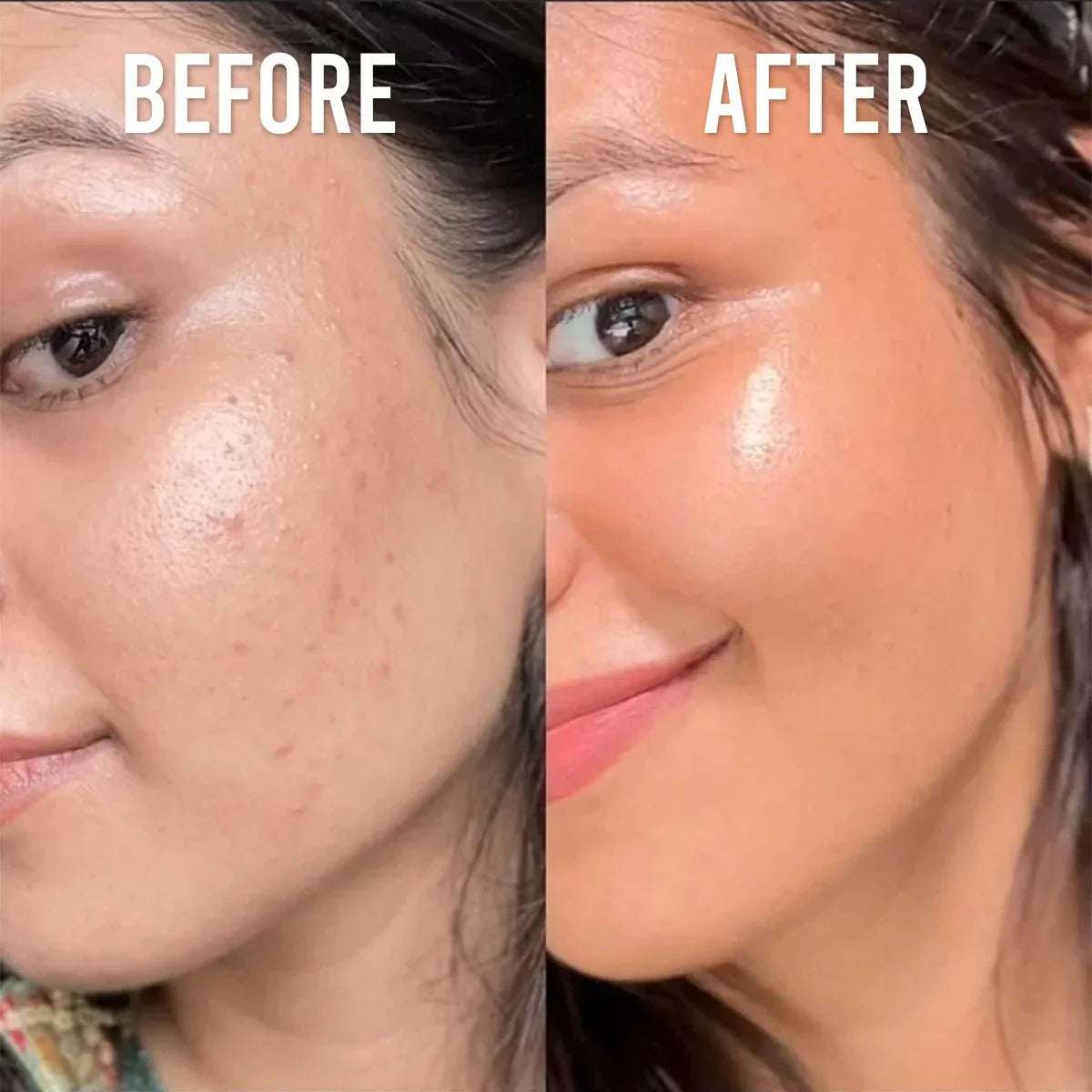 Glow & Firm Bundle – 30 Days Pack - Mumzar