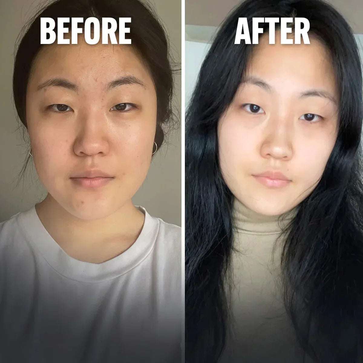 Glow & Firm Bundle – 30 Days Pack - Mumzar