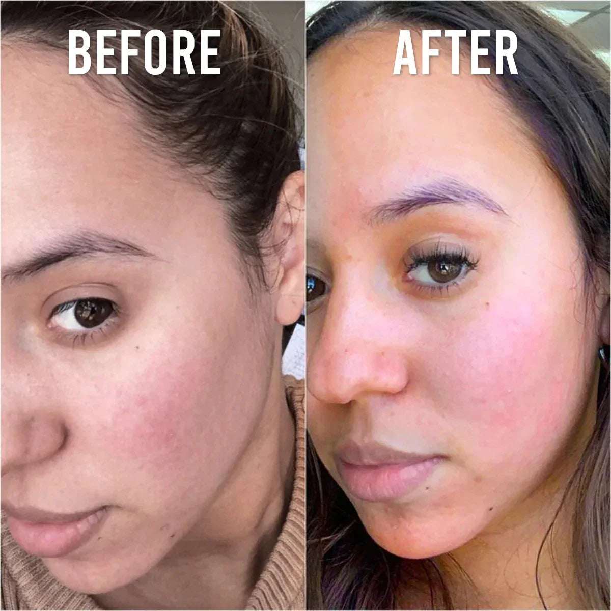 Glow & Firm Bundle – 30 Days Pack - Mumzar