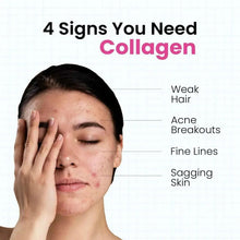 Woman with hand on face beside text listing signs you need collagen