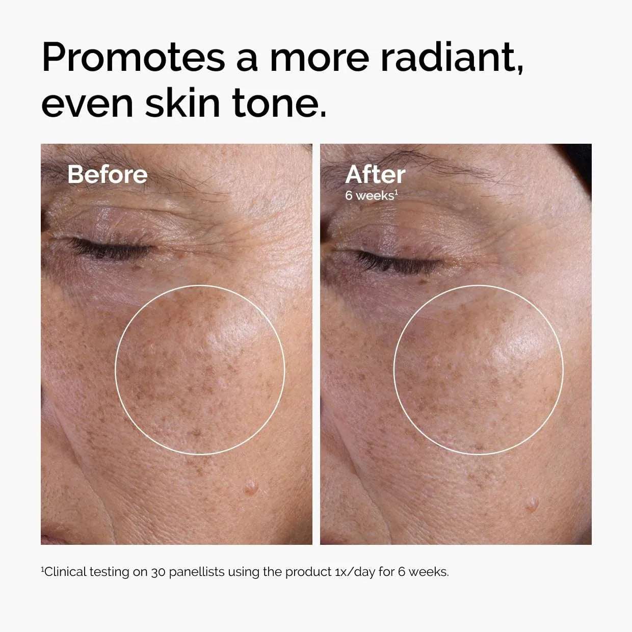 The Ordinary Glycolic Acid 7% Exfoliating Toner – Brightening & Smoothing - Mumzar