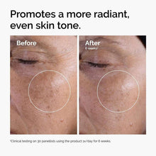 Skin tone before-and-after comparison with circled area, after looks more even