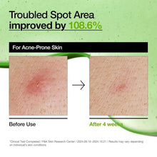 Acne-related redness before-and-after test panels labeled for troubled spots