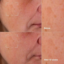 Close-up cheek skin with dark spots and faint lines showing before vs after