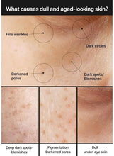 Brightening cream skincare concerns diagram, dark spots, pores, wrinkles, dullness