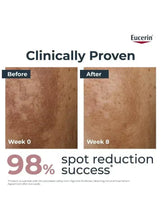 Eucerin even pigment serum before-and-after skin spot reduction panels