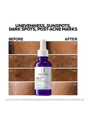 La Roche-Posay Mela B3 Anti-Dark Spots Concentrate Serum with Niacinamide 30ml - Mumzar