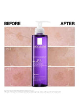 La Roche-Posay Mela B3 micro-peeling gel bottle with before-and-after skin panels