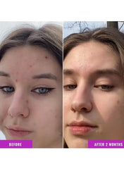 Good Molecules Niacinamide Serum 10% – Balancing & Brightening B3 Facial Serum