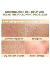 Niacinamide serum chart showing uneven complexion, thick pores, and dry skin
