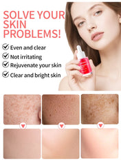 MOOYAM Niacinamide 10% + TXA 4% Dark Spot Correcting Serum – Hyperpigmentation & Acne Marks Treatment 30ml