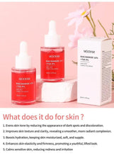 Niacinamide + TXA dark spot correcting serum set: red bottle, dropper, and box