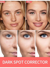 Before-and-after face skin comparison featuring a dark spot correcting serum bottle