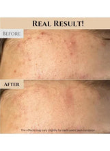 Skin before and after using ground rice and honey glow mask